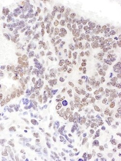 SRp55 Antibody, Novus Biologicals 0.1mg; Unlabeled:Antistoffer